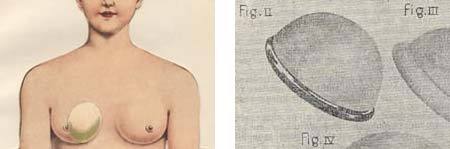 De vrouw : haar bouw en haar inwendige organen : aanschouwelijk voorgesteld door beweegbare platen en met geïllustreerden, verklarenden tekst : een populaire schets